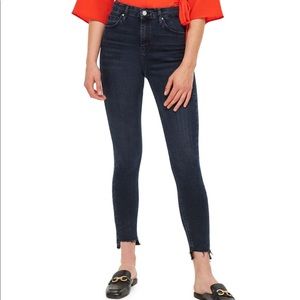 Topshop Jamie Step Hem Skinny Jeans